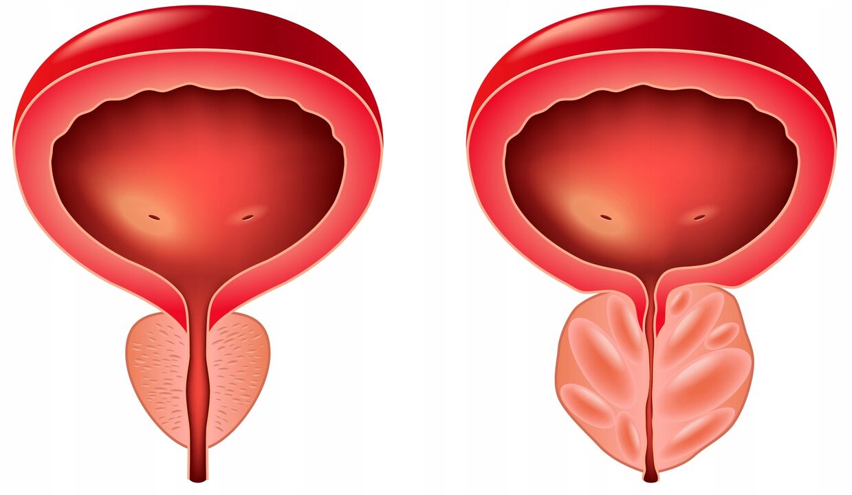 difference between the prostate glands